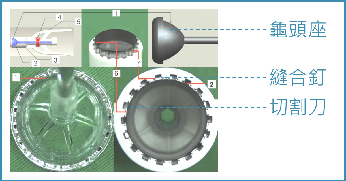 包皮槍手術器械示意圖