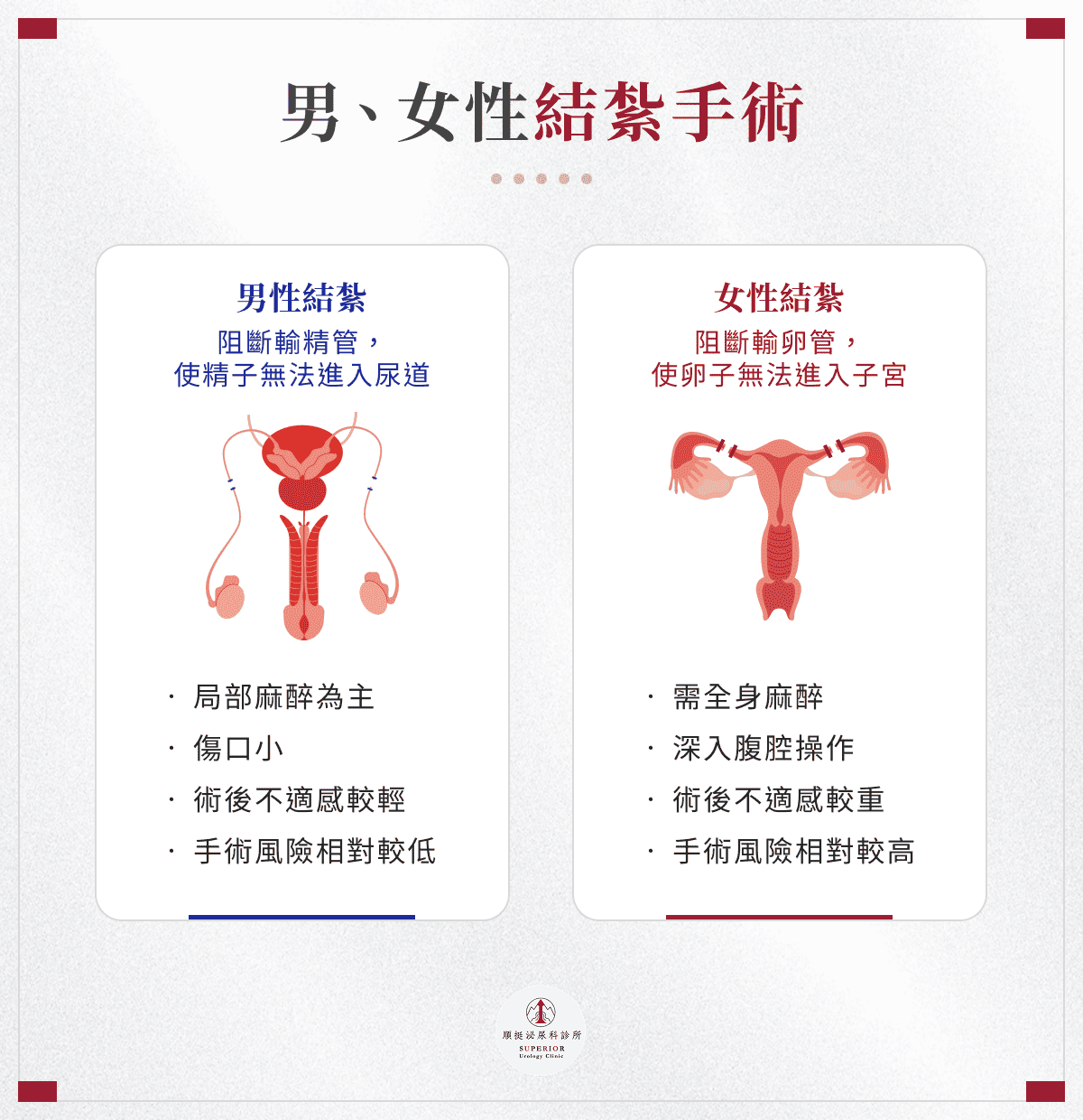男、女性結紮手術