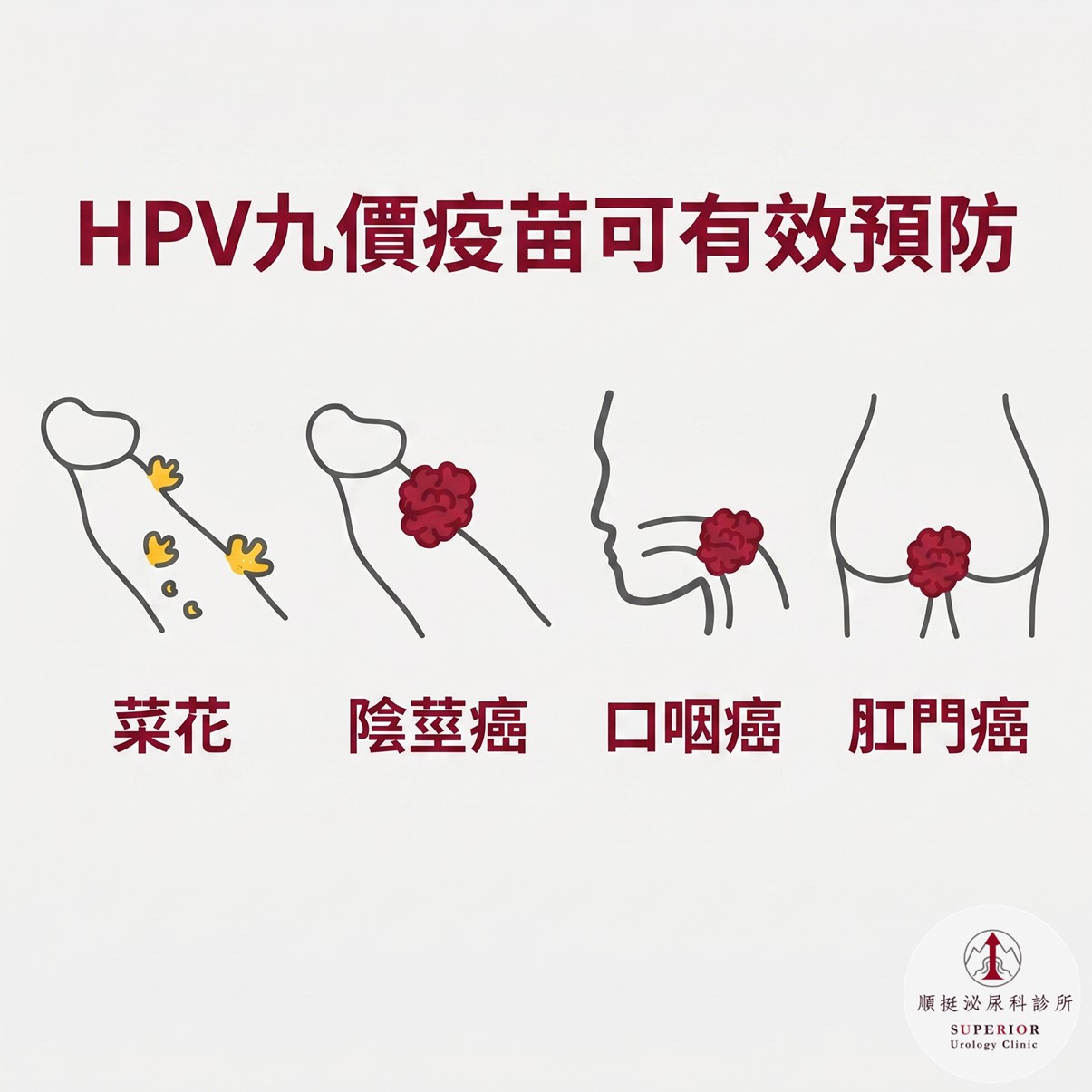HPV 九價疫苗可預防疾病示意圖，包含菜花、肛門癌、頭頸癌與陰莖癌，順挺泌尿科衛教圖解