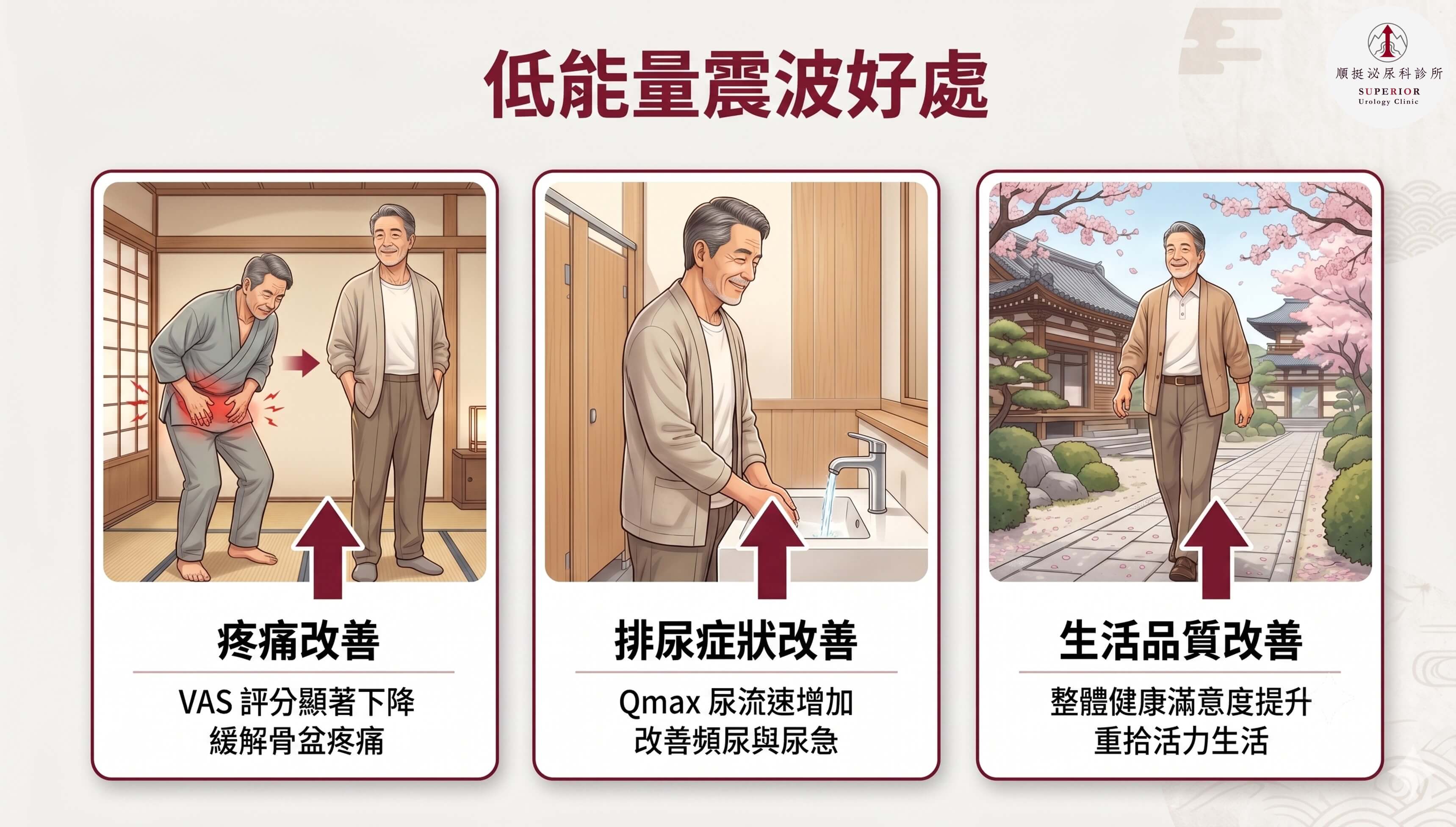 低能量震波治療慢性攝護腺炎臨床改善數據：疼痛、排尿症狀、生活品質三項指標