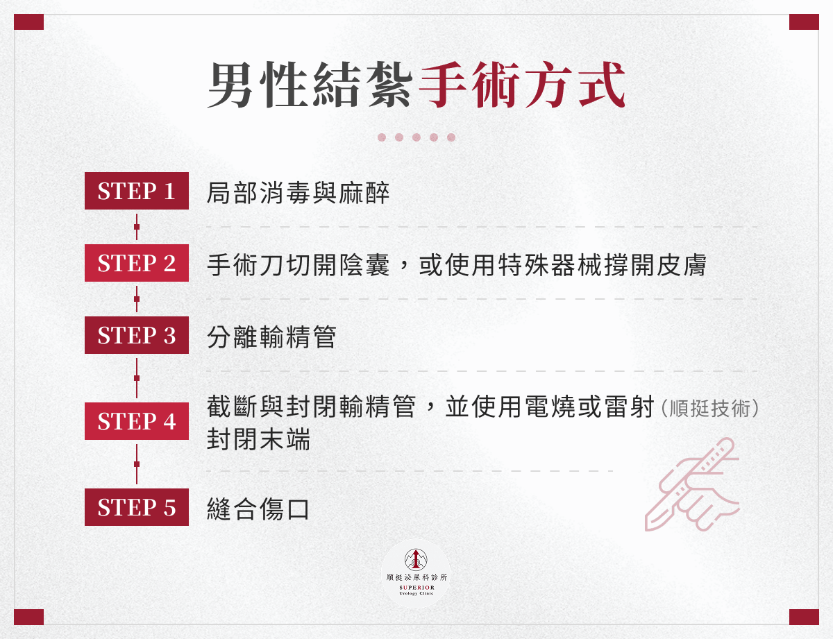男性結紮手術方式